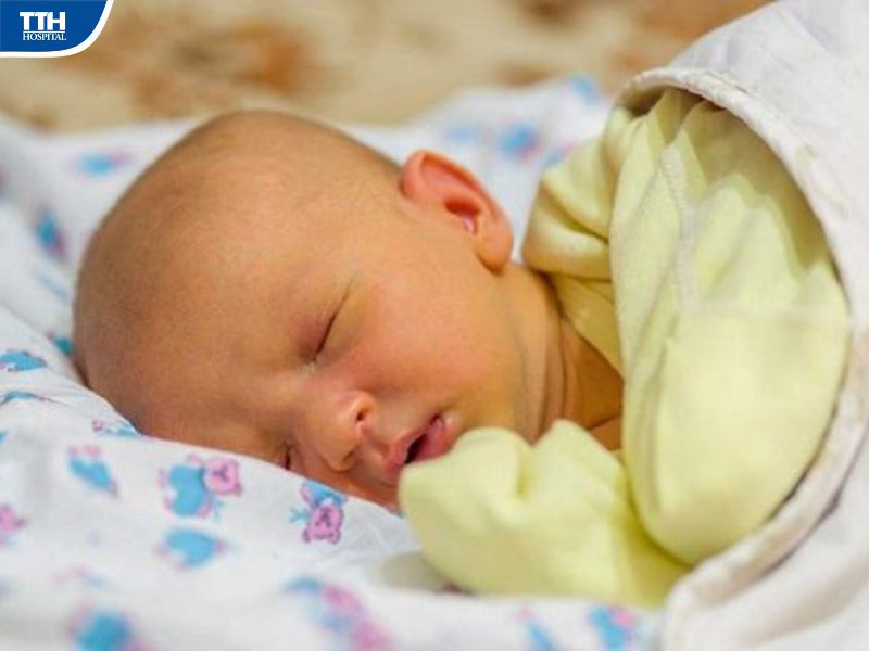 Biến chứng nguy hiểm từ vàng da bệnh lý ở trẻ sơ sinh
