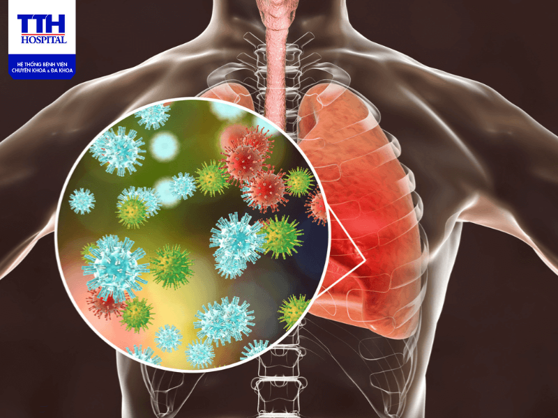 Sốt virus hay sốt siêu vi dễ lây lan từ người bệnh ra cộng đồng