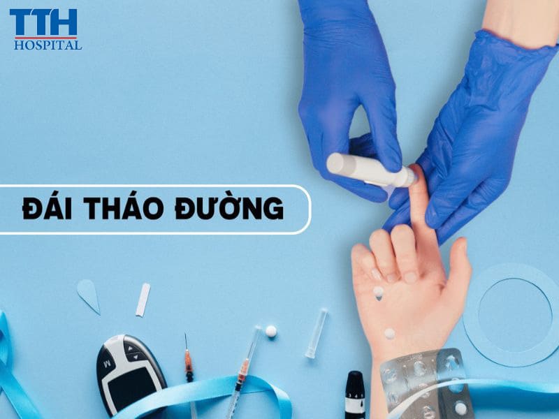 Các loại đái tháo đường thường gặp