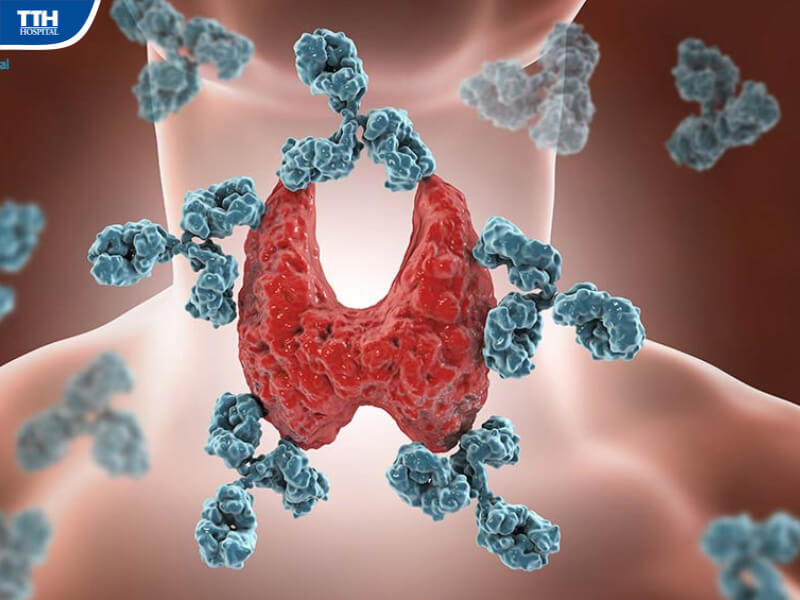 Các phương pháp điều trị viêm tuyến giáp