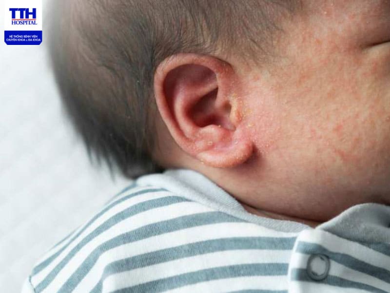 Cha mẹ cần lưu ý giữ cho không gian sinh hoạt của trẻ luôn thông thoáng, mát mẻ và sạch sẽ