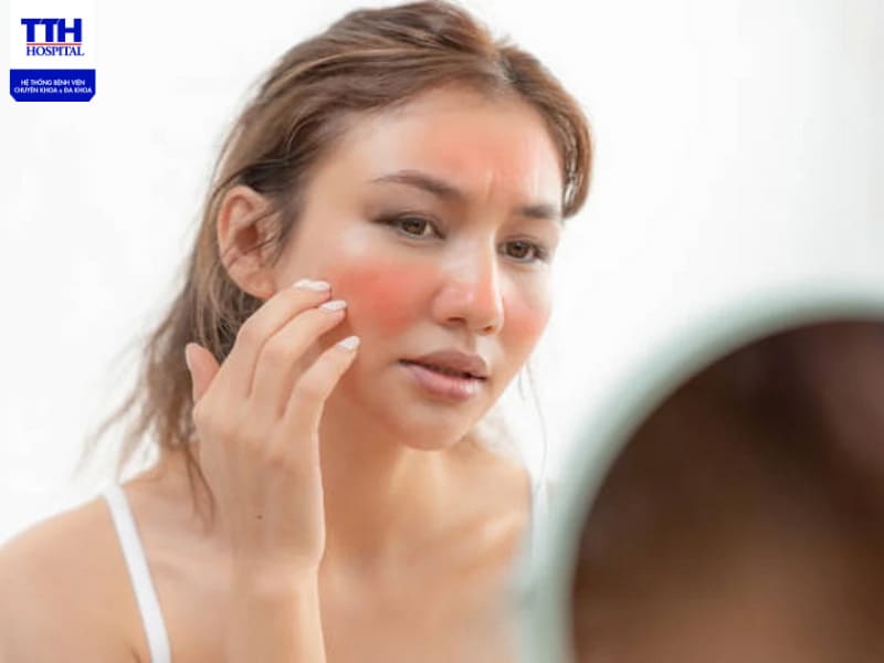 Cháy nắng gây sạm da, lão hóa sớm hoặc tăng nguy cơ ung thư da