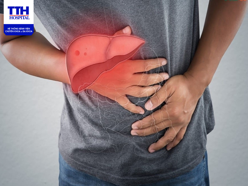 Top 10 thực phẩm hỗ trợ điều trị gan nhiễm mỡ