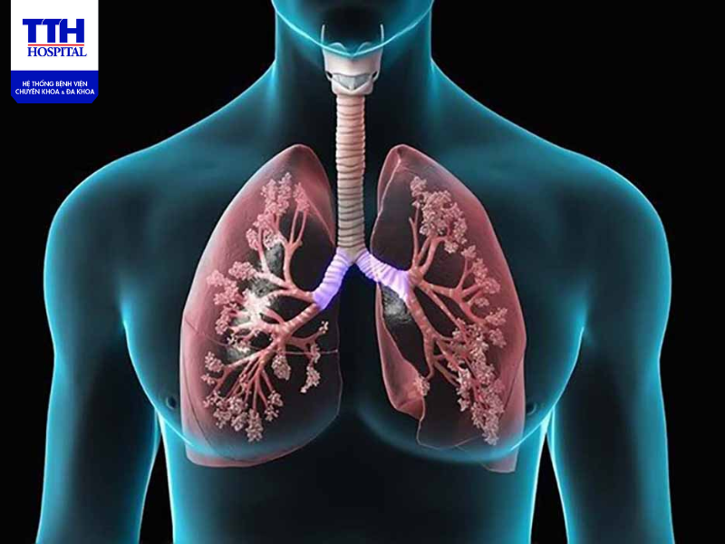 Cần đến các cơ sở y tế chuyên khoa để khám và điều trị dứt điểm nhằm tránh lây lan