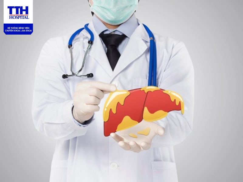 Trong quá trình điều trị gan nhiễm mỡ cần hạn chế 1 số thực phẩm làm ức chế quá trình