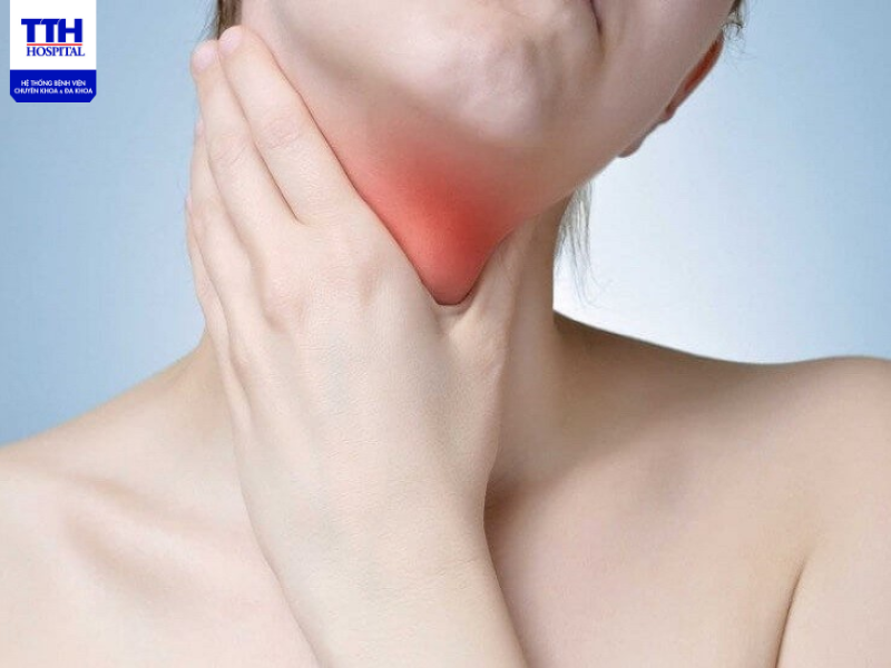 Cần phòng ngừa như thế nào để tránh mắc bệnh bướu cổ