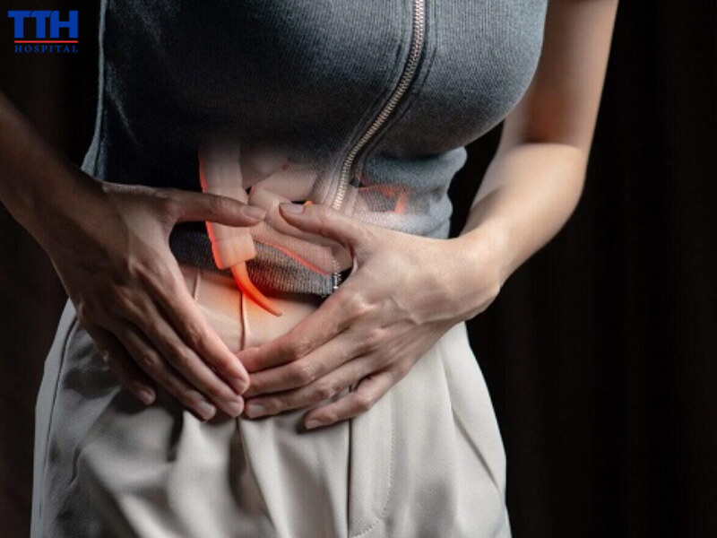 Viêm ruột thừa cấp thừa biểu hiện triệu chứng đau bụng vùng bụng dưới bên phải