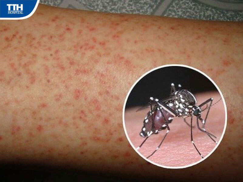 Khi nào cần đến bệnh viện ngay?