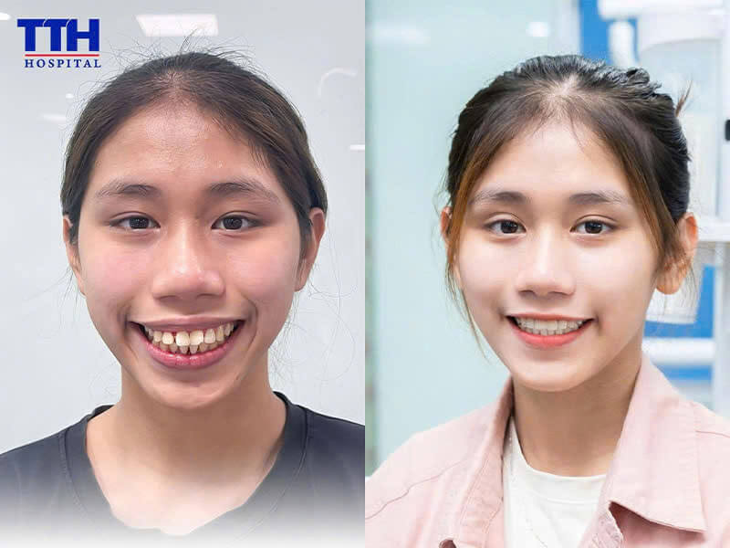 Lịch hẹn – linh hoạt nhưng không nên trì hoãn