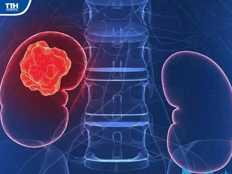 Nguyên nhân khởi phát bệnh 