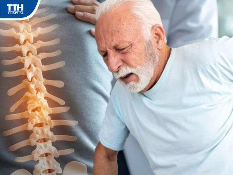 Triệu chứng để nhận biết loãng xương