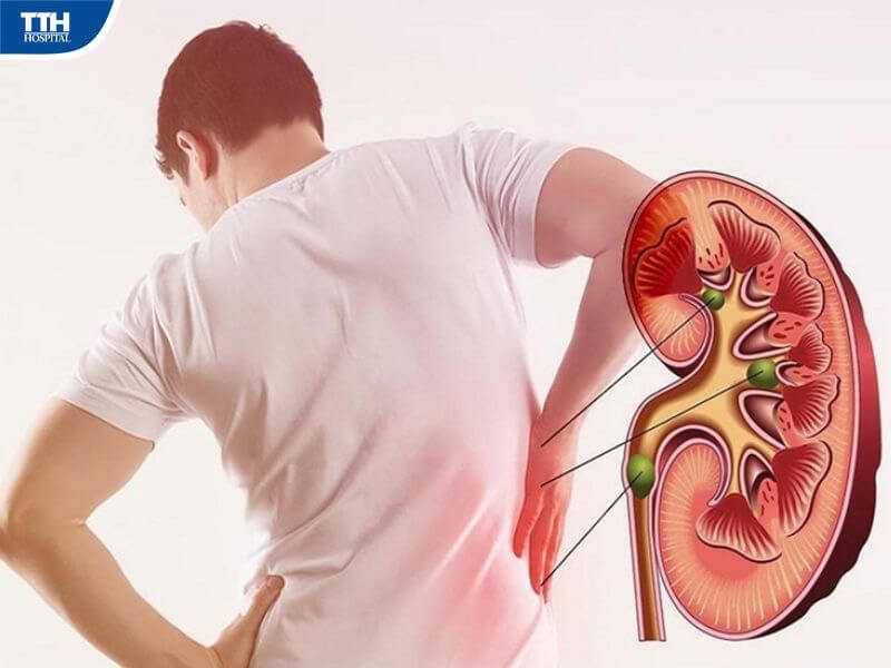 Triệu chứng nhận biết bệnh thận mạn tính