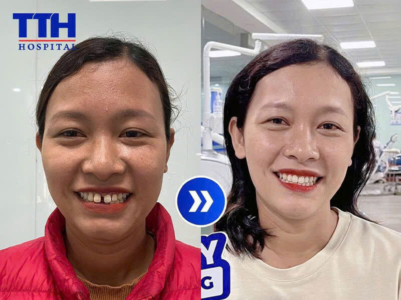 Vì sao tái khám lại quan trọng đến vậy?