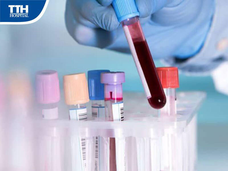 Xét nghiệm tổng quát định kỳ tại TTH Hospital