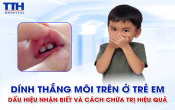 Dính thắng môi trên ở trẻ em: Dấu hiệu nhận biết và cách chữa trị hiệu quả