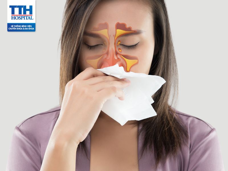 Viêm mũi dị ứng: Triệu chứng, nguyên nhân và điều trị