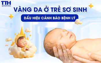 Vàng da ở trẻ sơ sinh: Dấu hiệu cảnh báo bệnh lý