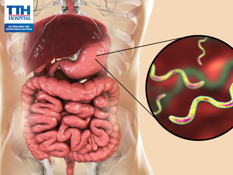 Vi khuẩn HP lây qua đường nào? Chẩn đoán nhiễm khuẩn HP